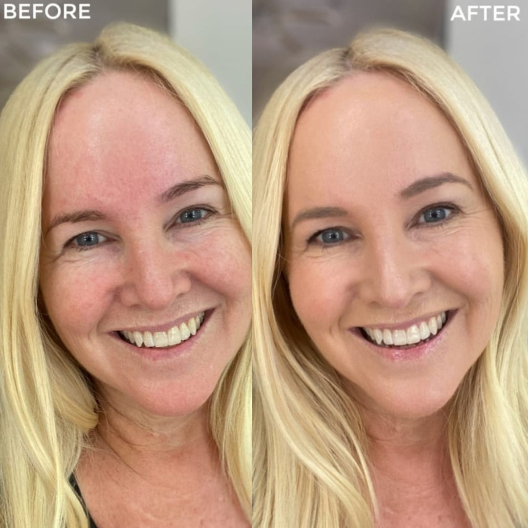 Elorel Treshly Magic Foundation Stick